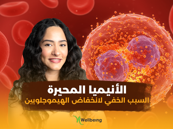 card-img