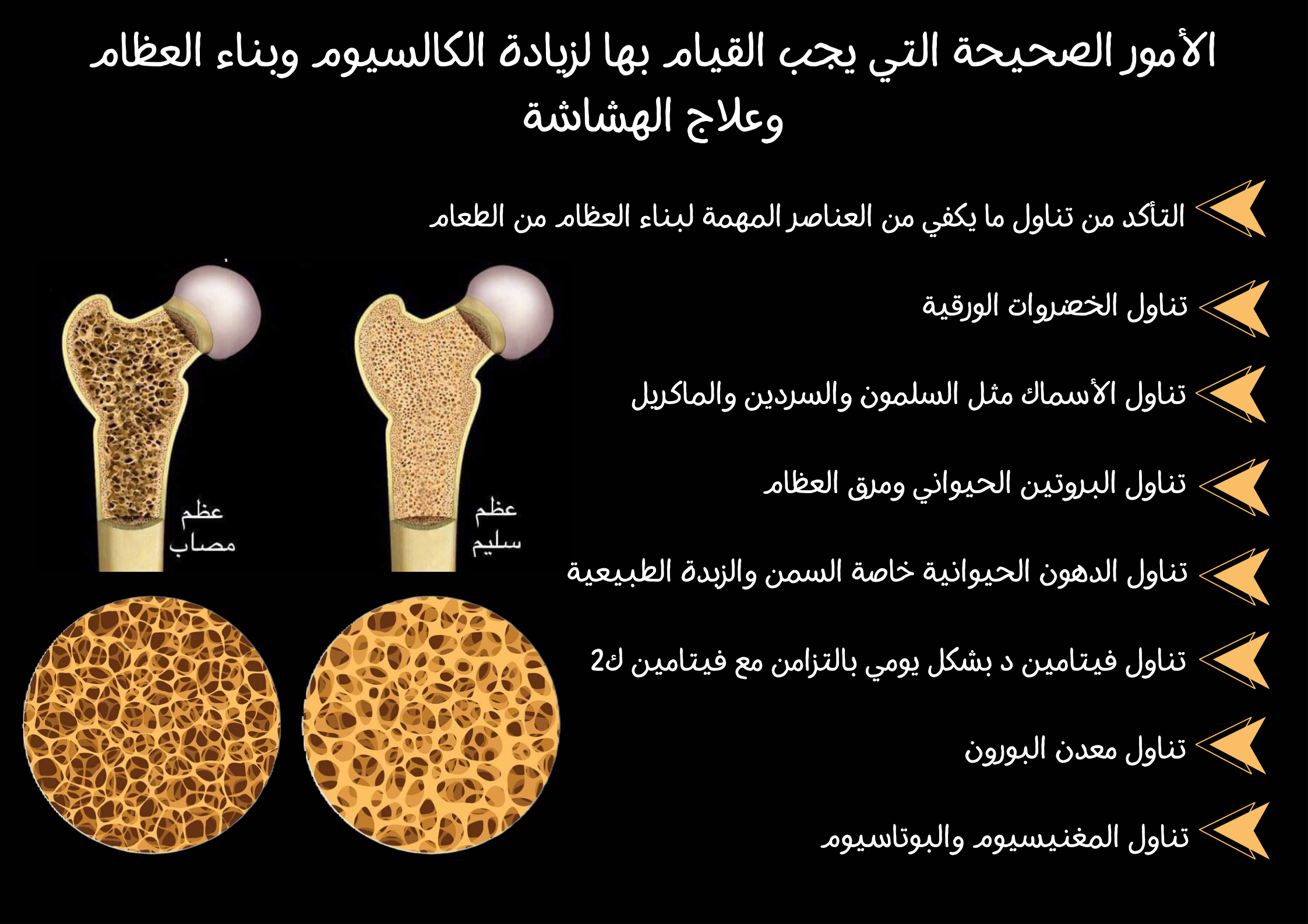 الأمور الصحيحة التي يجب القيام بها لزيادة الكالسيوم وبناء العظام وعلاج الهشاشة