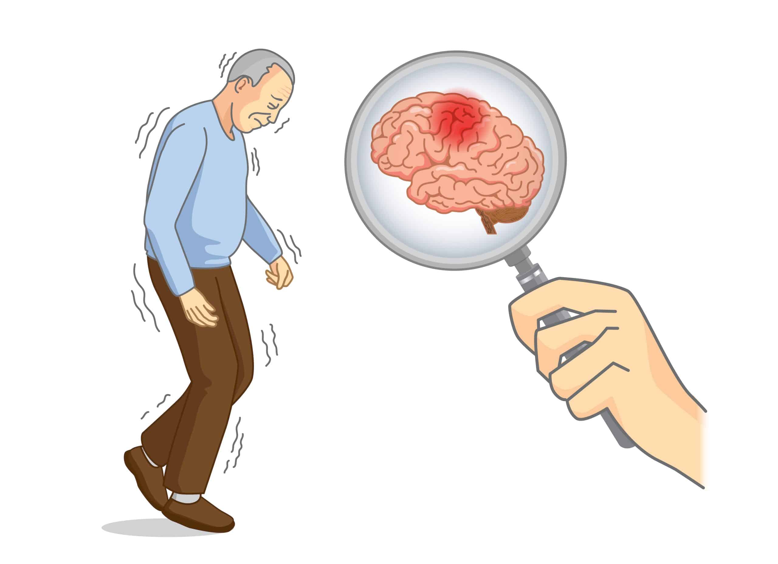 Parkinson's باركنسون	
