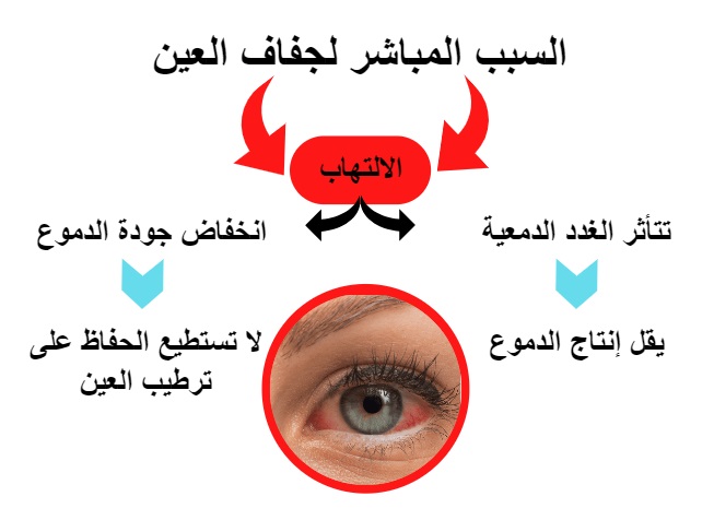 السبب المباشر لجفاف العين