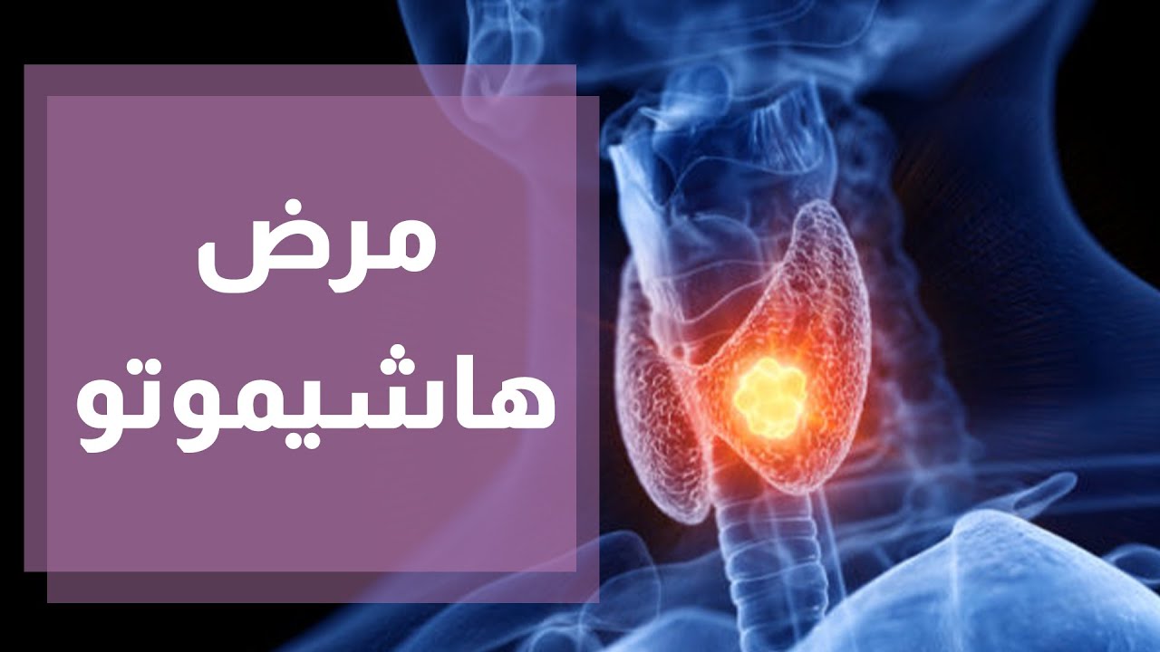 هاشيموتو