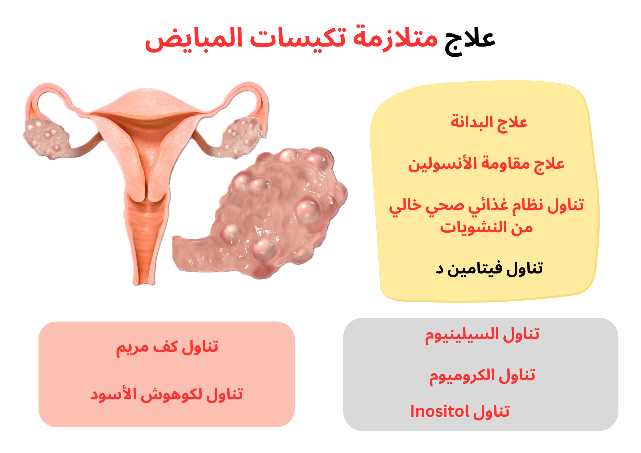 علاج متلازمة تكيسات المبايض	
