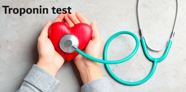 troponin test	