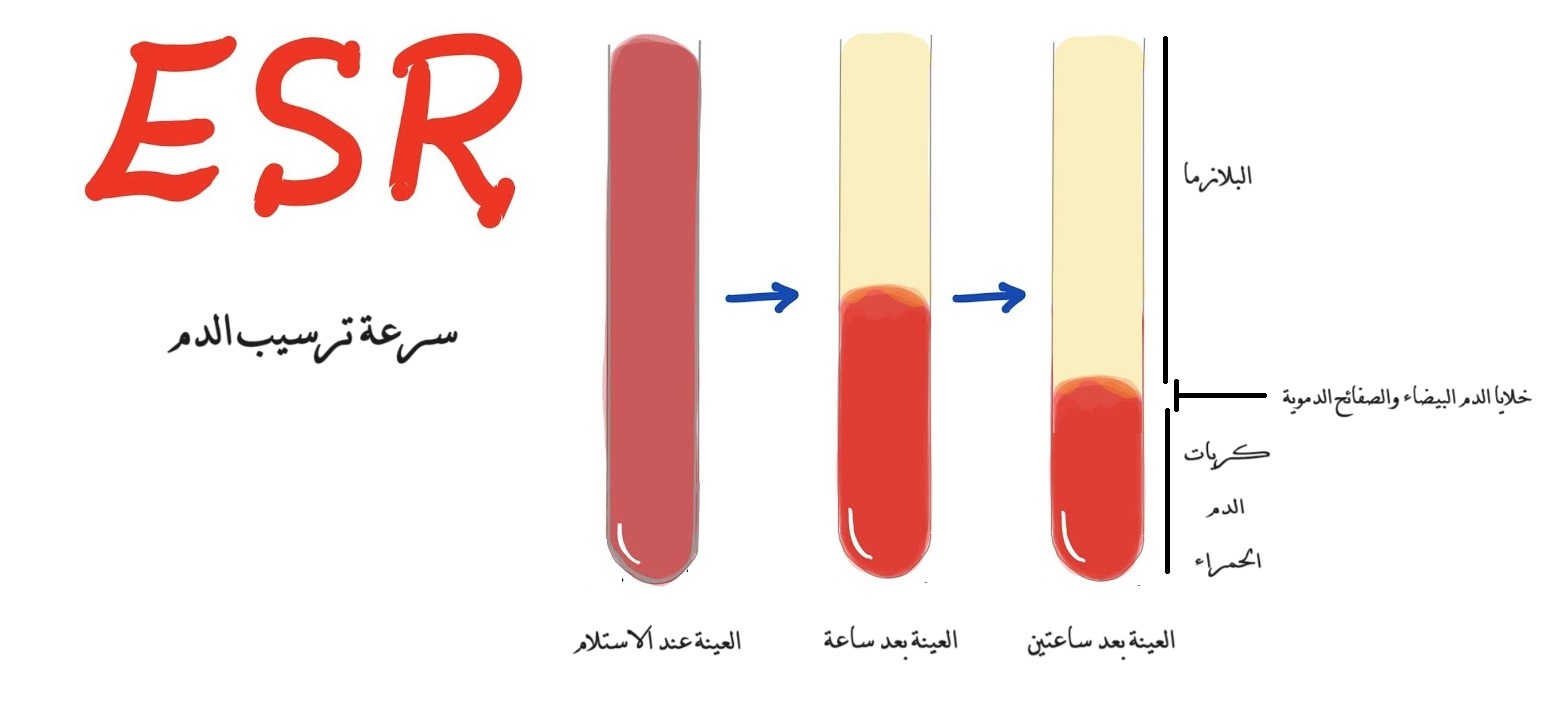 ESR سرعة ترسيب الدم	