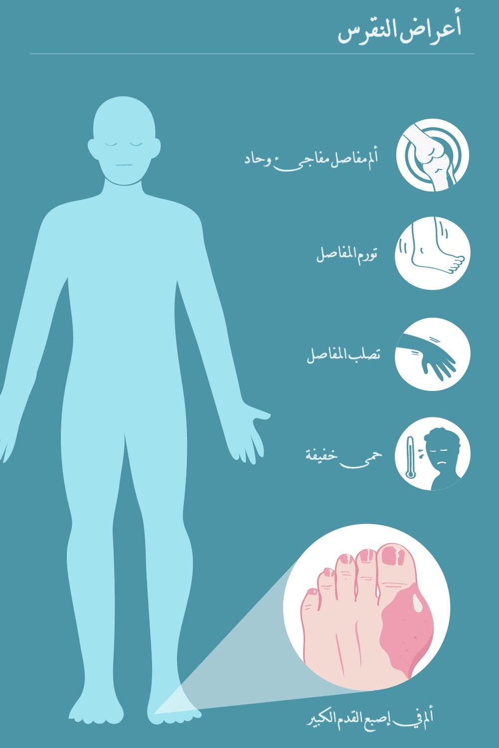 أعراض النقرس