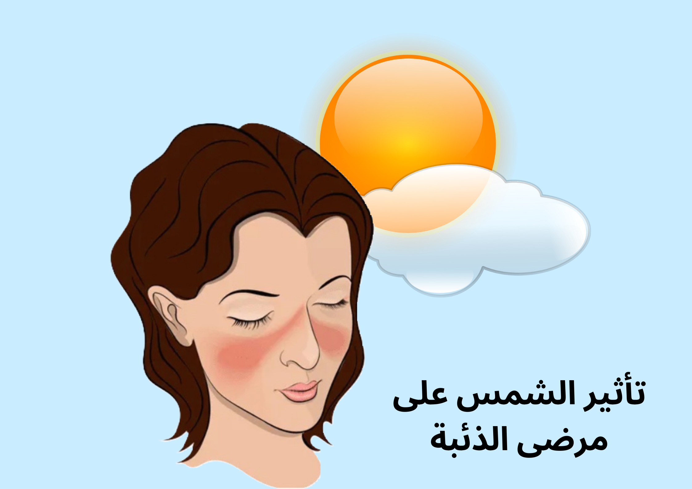 تأثير الشمس على مرضى الذئبة	