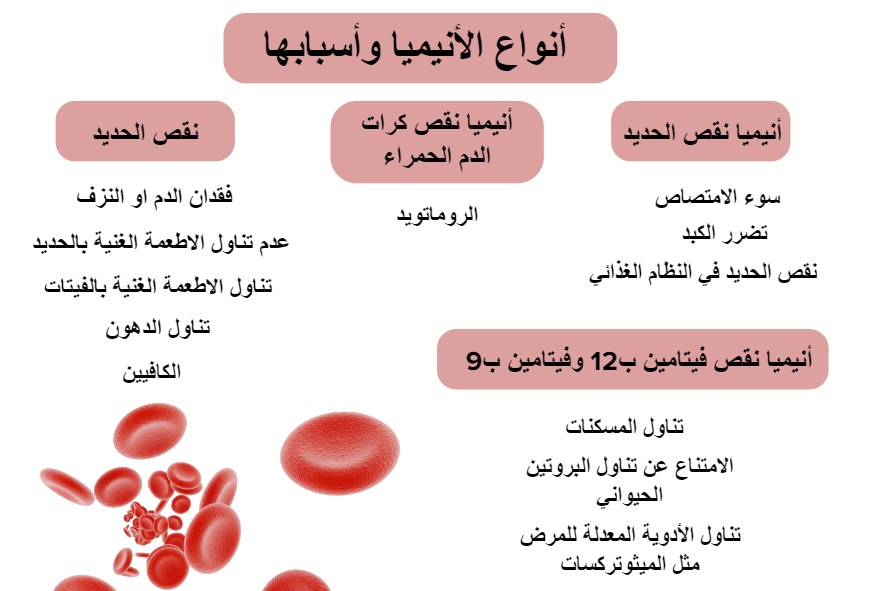 أنواع الأنيميا وأسبابها