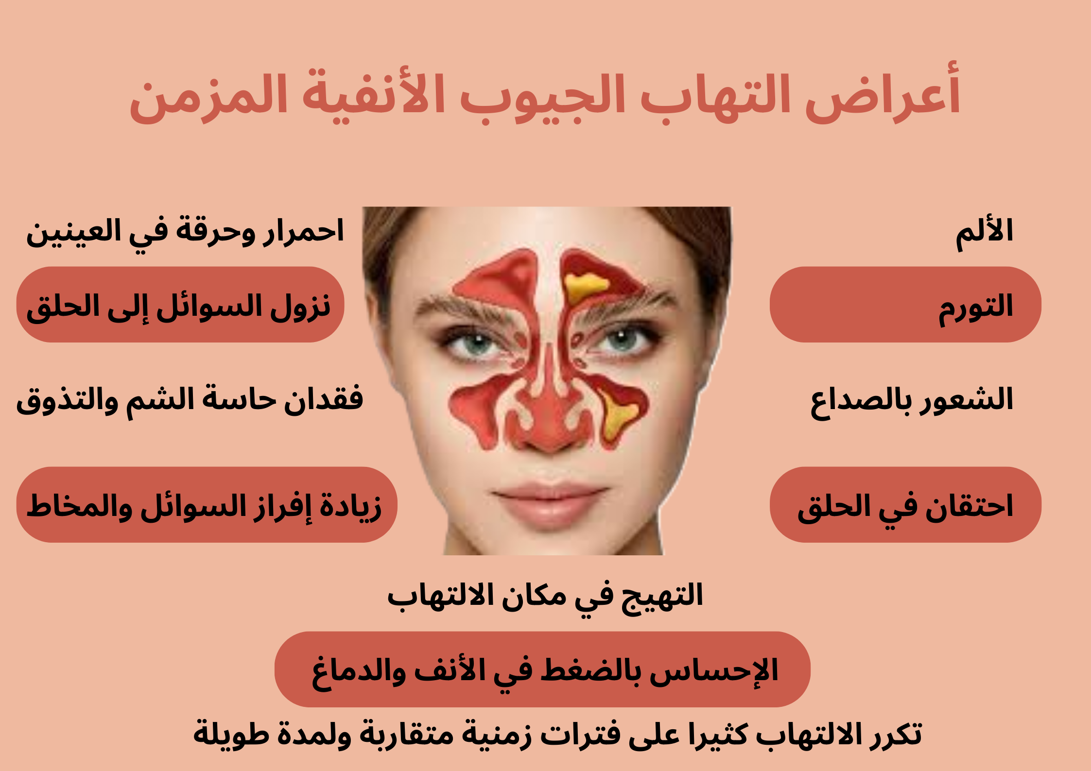 أعراض التهاب الجيوب الأنفية المزمن	