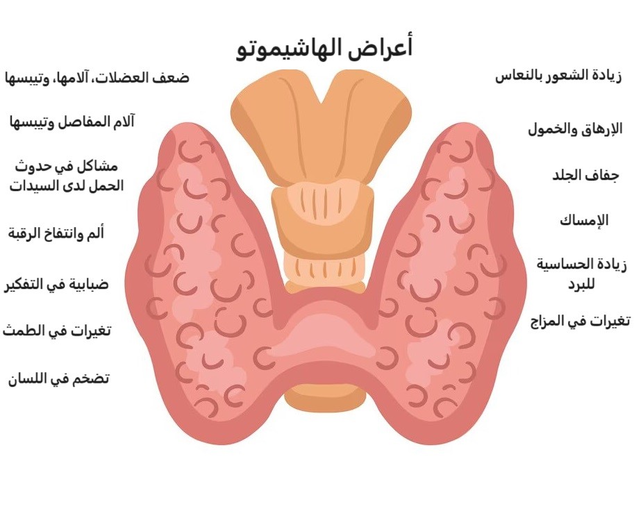 أعراض الهاشيموتو