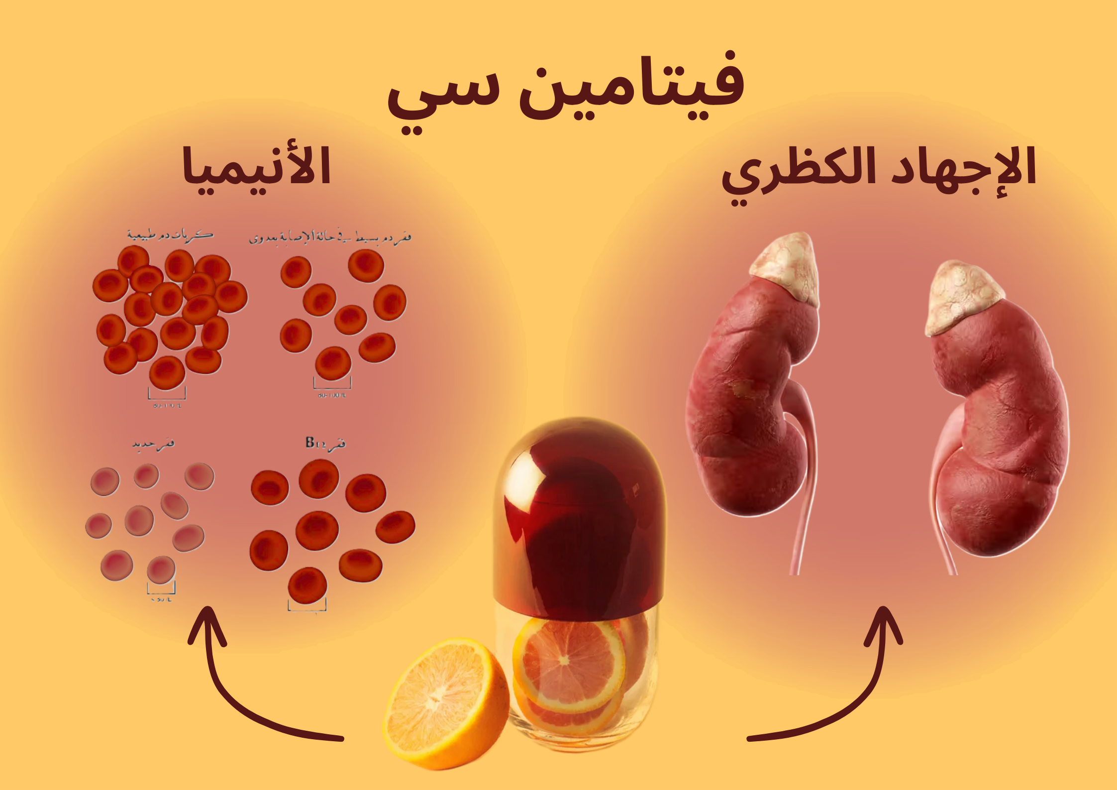 فيتامين سي الأنيميا الإجهاد الكظري	