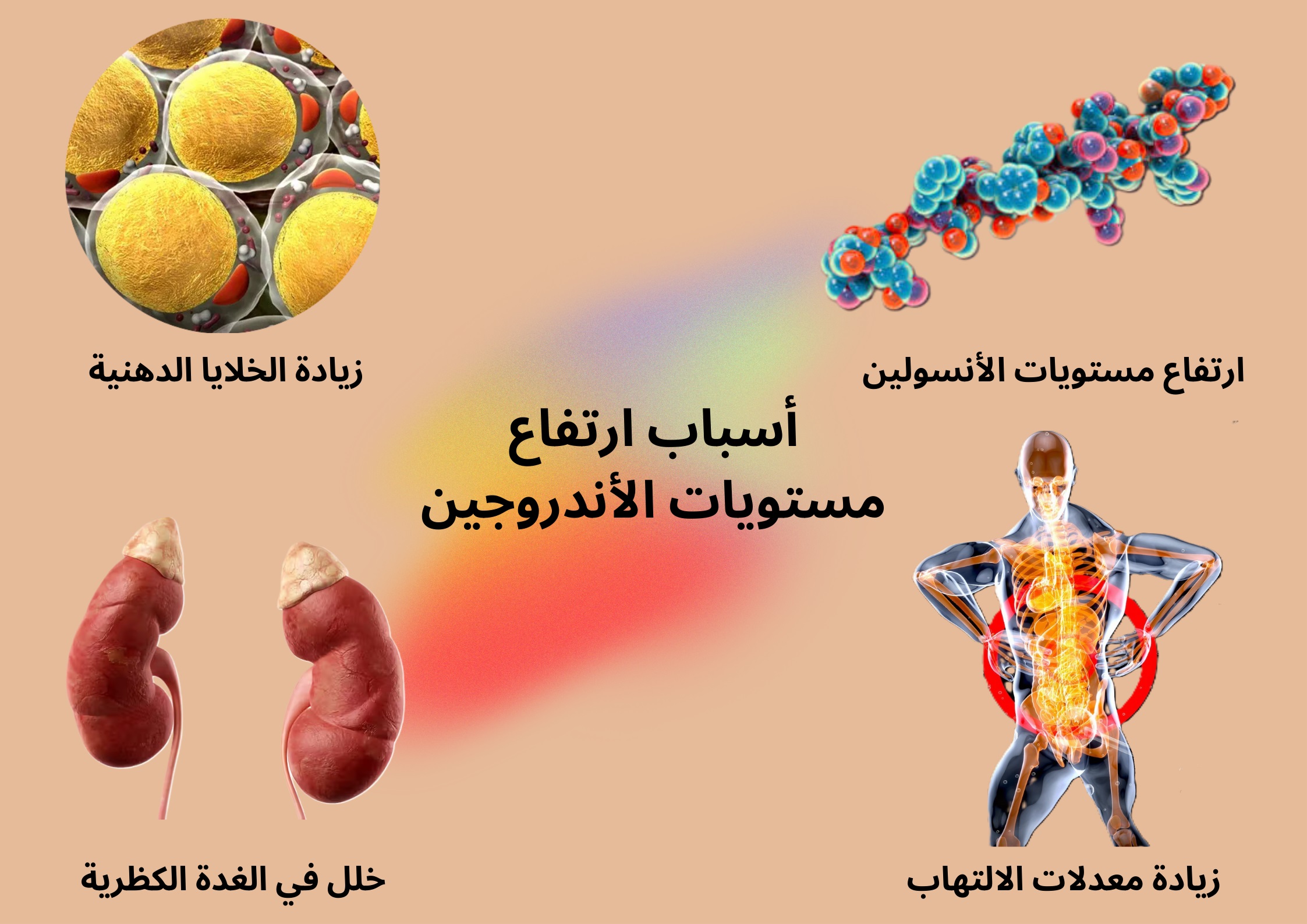 سبب ارتفاع مستويات الأندروجين	