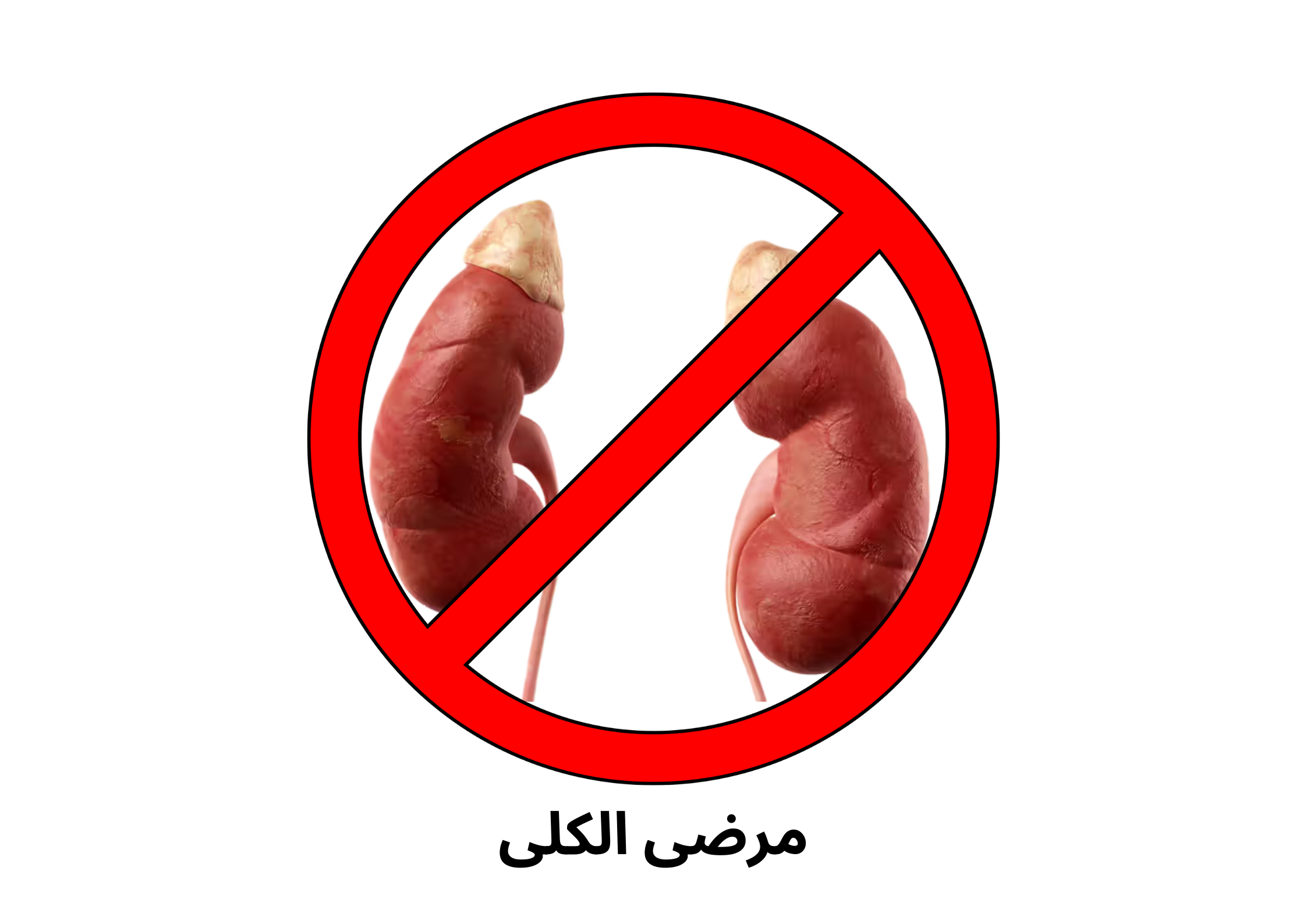 ممنوع على مرضى الكلى	