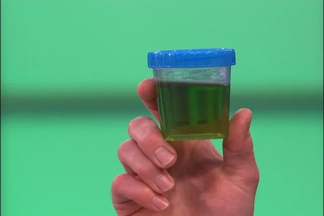 بول أخضر اللون