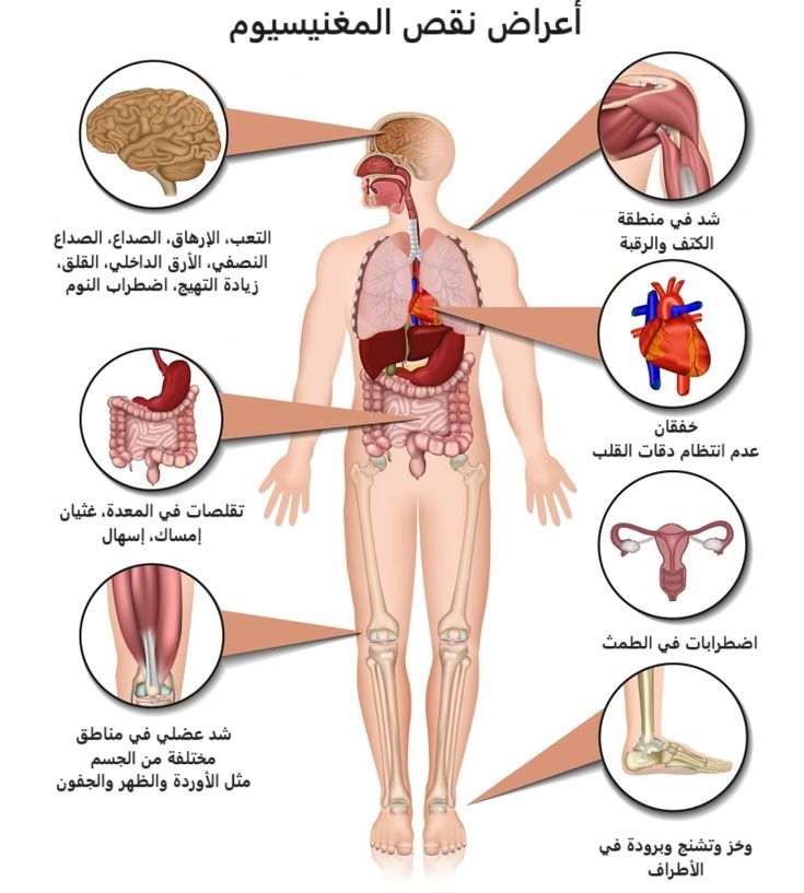 أعراض نقص المغنيسيوم